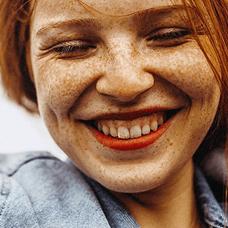 How to embrace your freckles